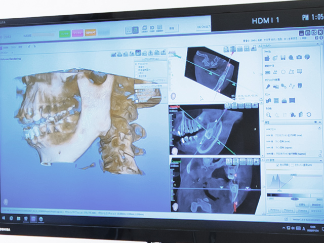 歯科用CT